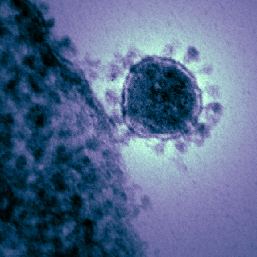 Magnified and digitally colorized image of the Middle East respiratory syndrome coronavirus (MERS-CoV) (Photo Courtesy of National Institute of Allergy and Infectious Diseases).