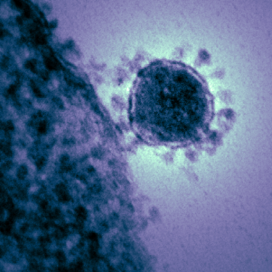 Magnified+and+digitally+colorized+image+of+the+Middle+East+respiratory+syndrome+coronavirus+%28MERS-CoV%29+%28Photo+Courtesy+of+National+Institute+of+Allergy+and+Infectious+Diseases%29.